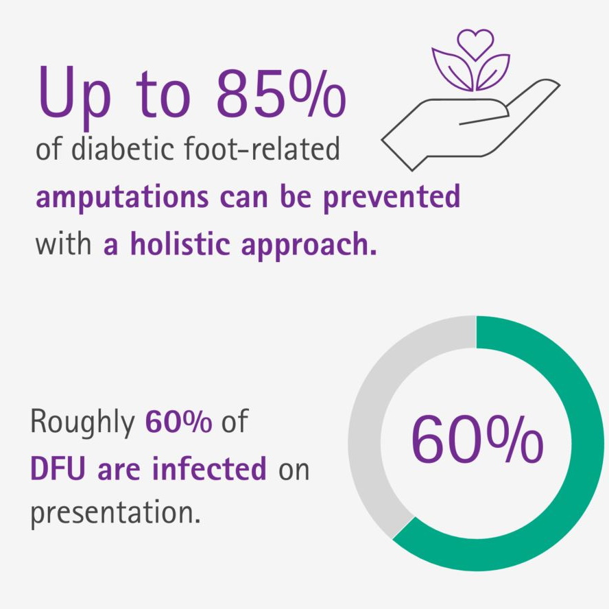 Prevention and treatment of diabetic foot ulcers